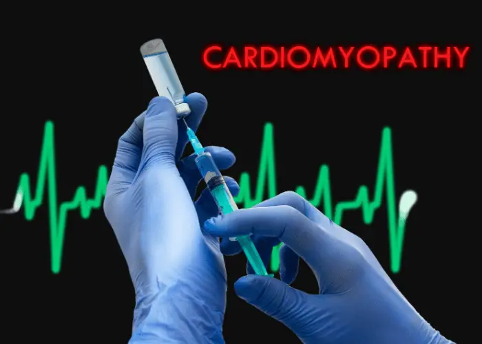 Cardiomyopathy illustration